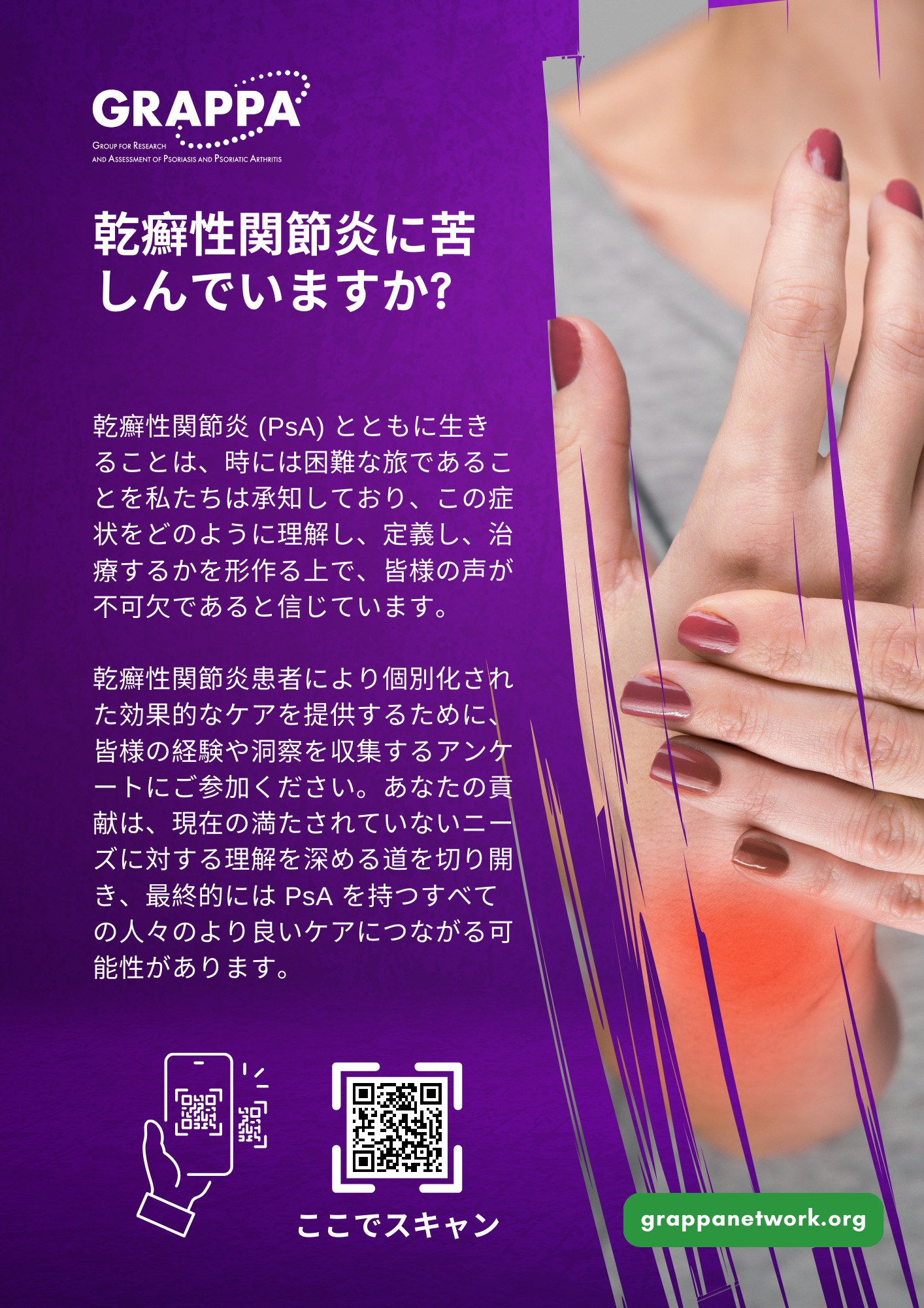 DT2 Patient Survey Flyer - Japanese