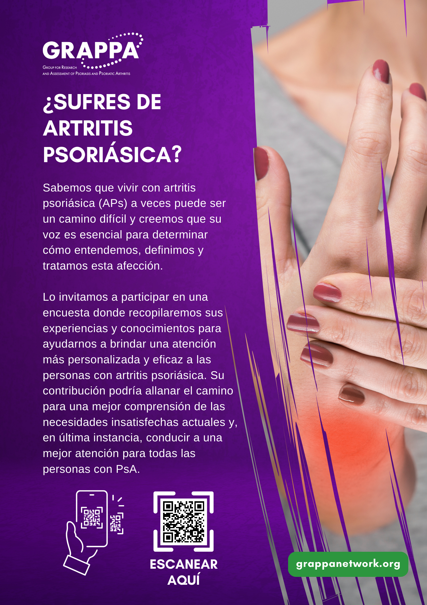 DT2 Patient Survey Flyer - Spanish
