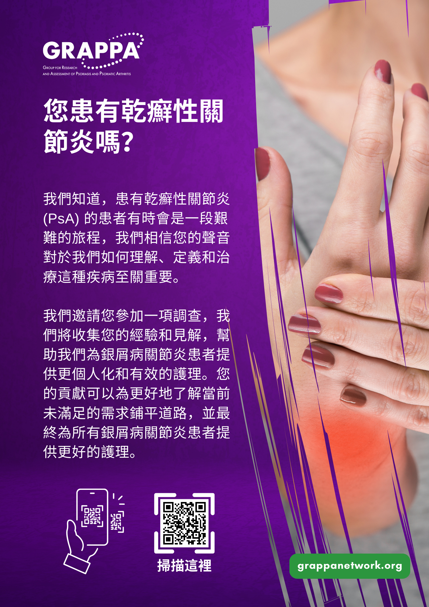 DT2 Patient Survey Flyer - Traditional Chinese